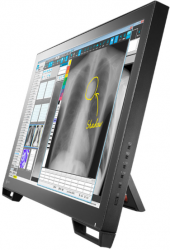 Monitor EIZO RadiForce MS236WT-A